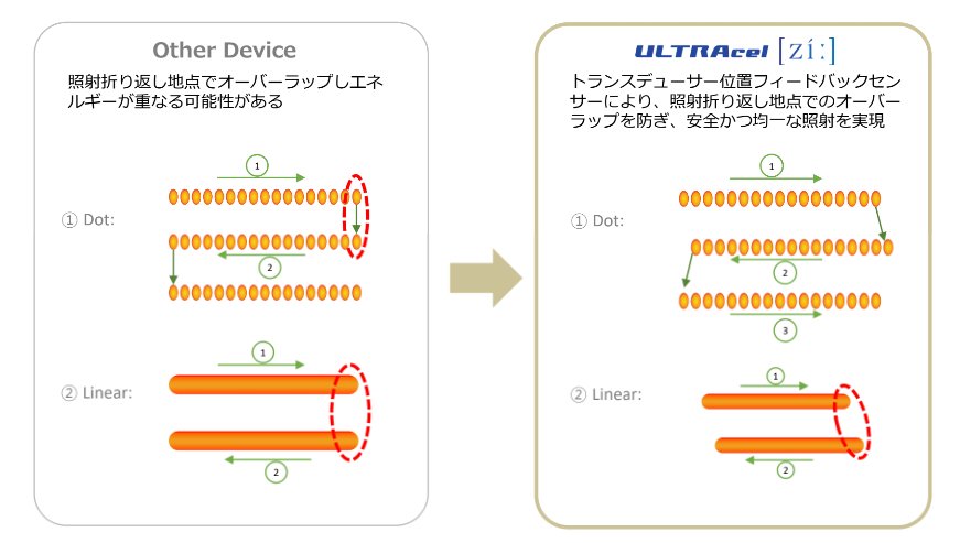 リニアモードのリポハイフ｜広範囲の脂肪層にアプローチ