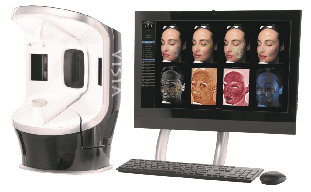 肌診断機 高性能肌診断機：VISIA（ビジア） 銀座・表参道にあるBIANCA CLINIC