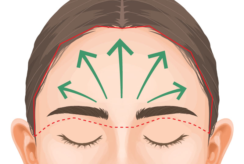 まぶたのたるみを改善したい！眉下切開・眼瞼下垂・前額リフト、違いを医師が解説