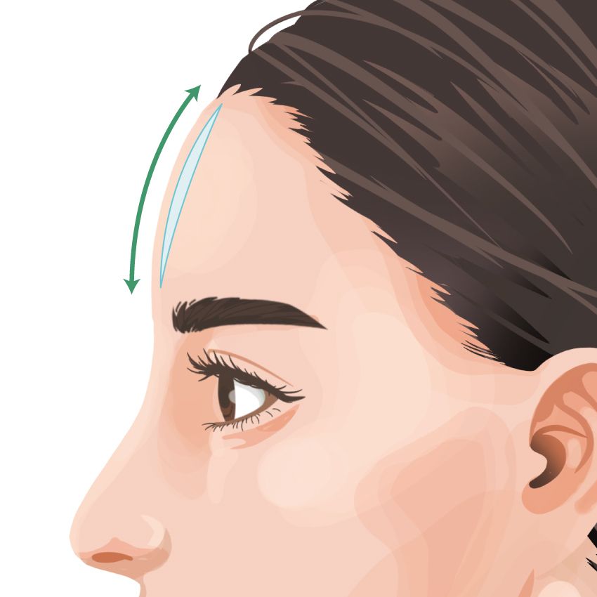 前額プロテーゼ ビアンカ銀座｜日本を代表する美容健康再生医療のクリニック