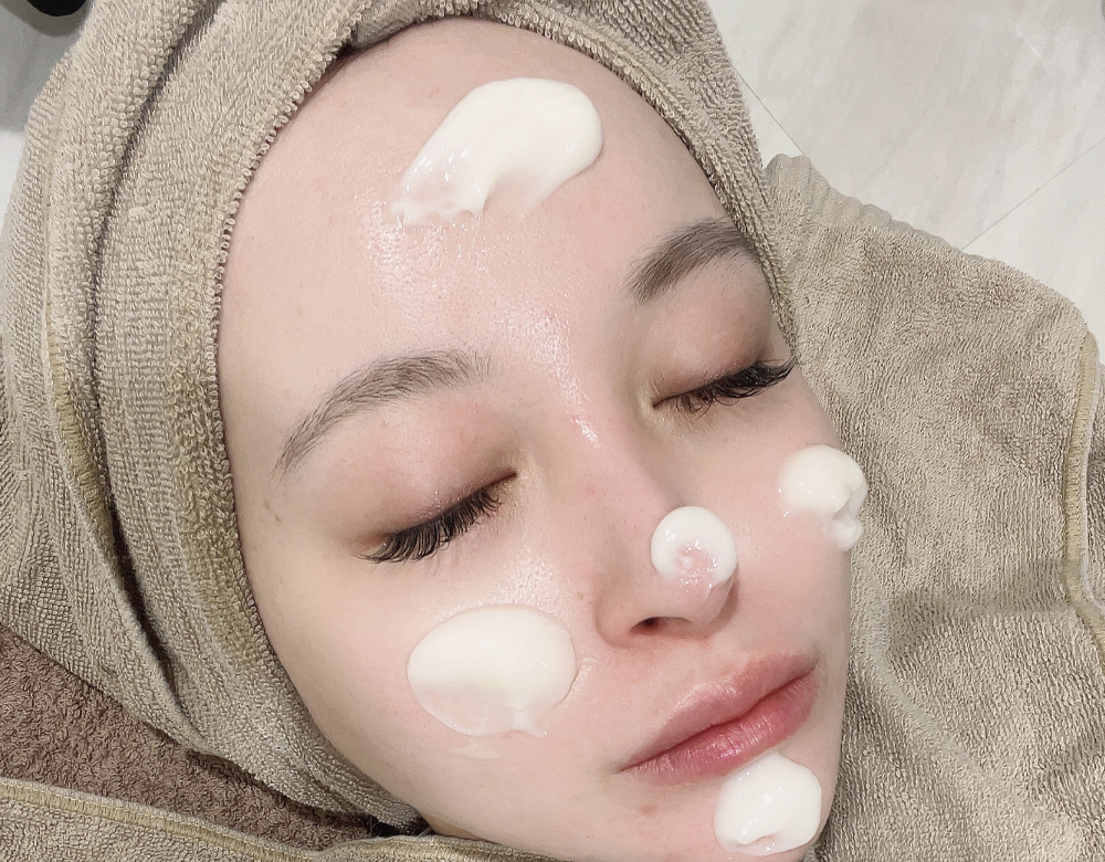 メソナJ（MESONA-J／メソポレーション）