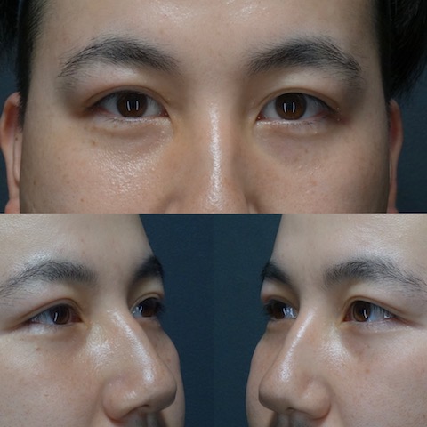 清潔感と凛々しさを引き出すメンズ美容