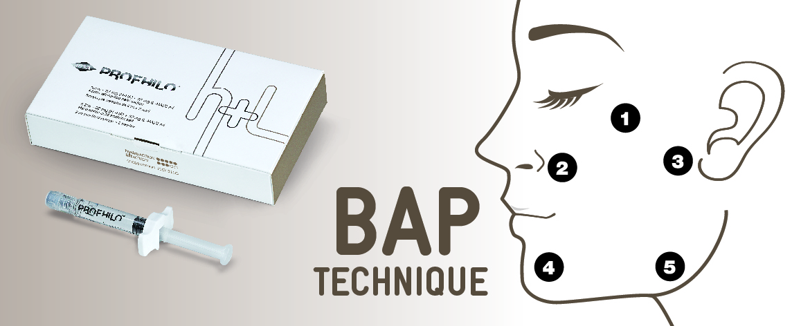 プロファイロ独自のBAP注入法