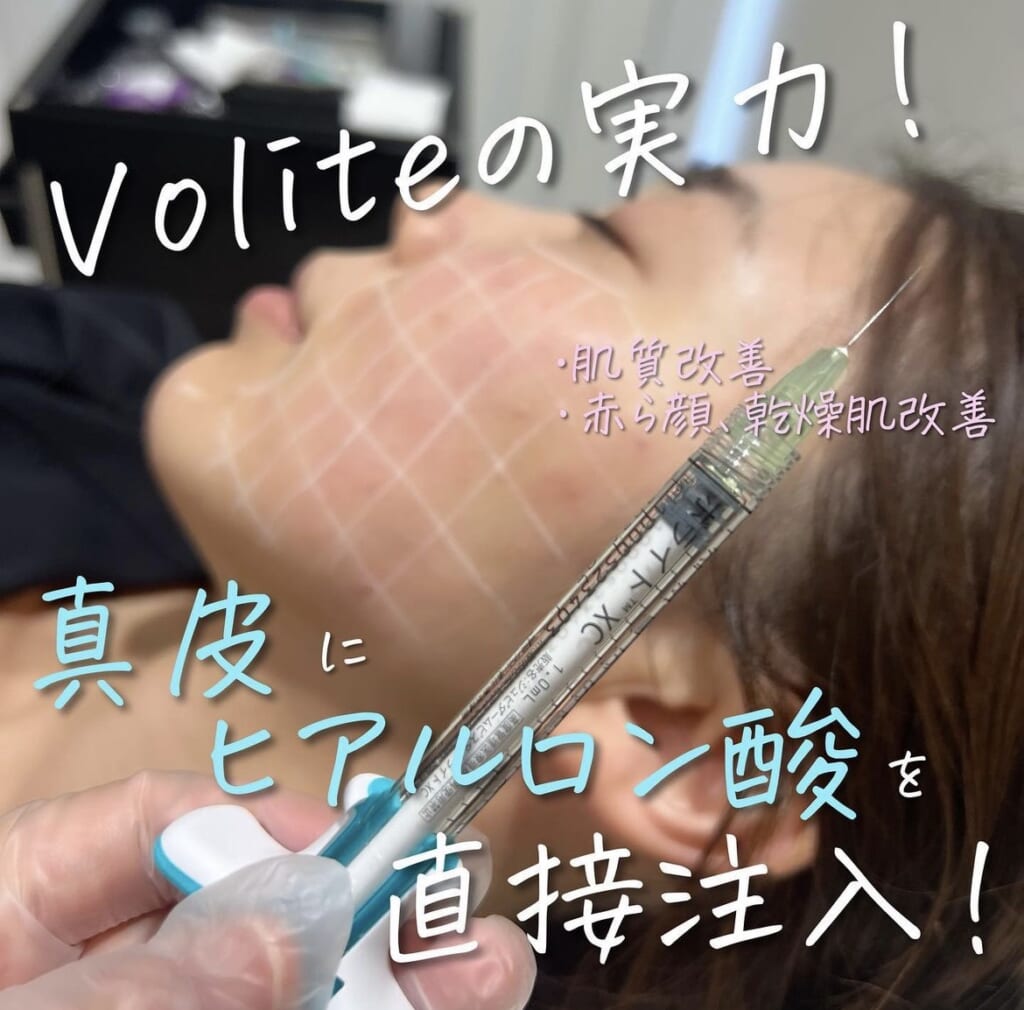 内側から潤うお肌になれるエンヴィーのご紹介❣