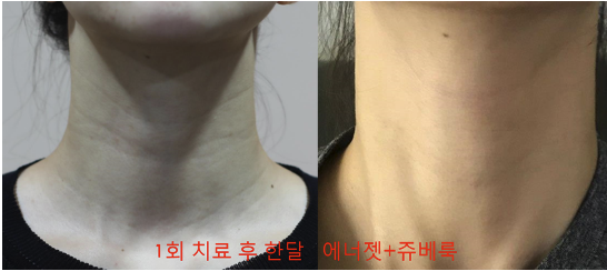 ジュベルック（Juvelook）