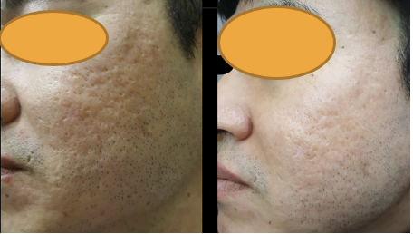 ジュベルック（Juvelook）