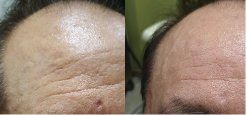 ジュベルック（Juvelook）