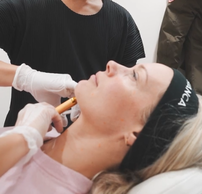 肌育目的のプロファイロと造形目的ヒアルロン酸製剤、どう違う？