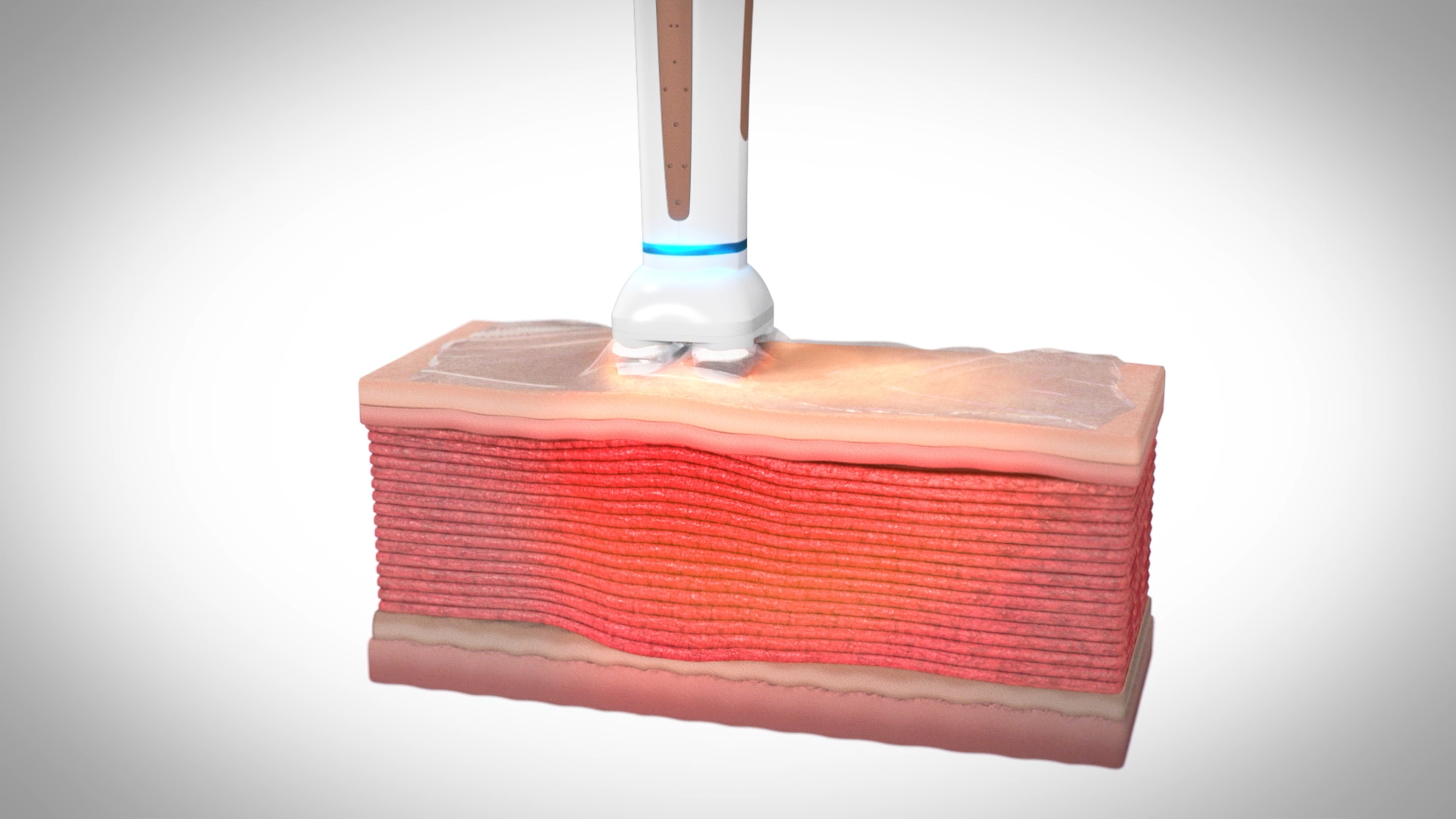 パーティーリフト（スマスアップネオ）とは