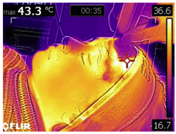 皮膚と筋肉の両方にアプローチできる