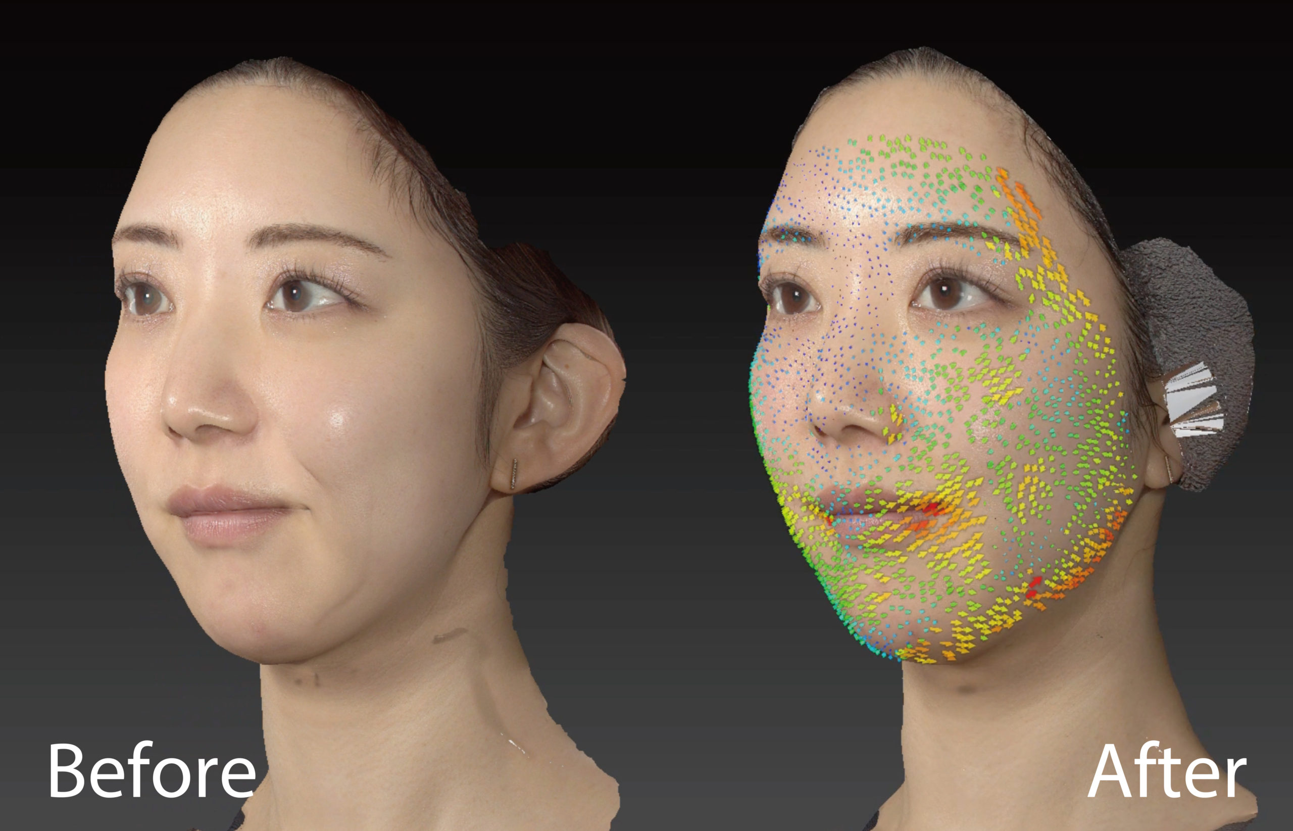 パーティーリフト（スマスアップネオ）