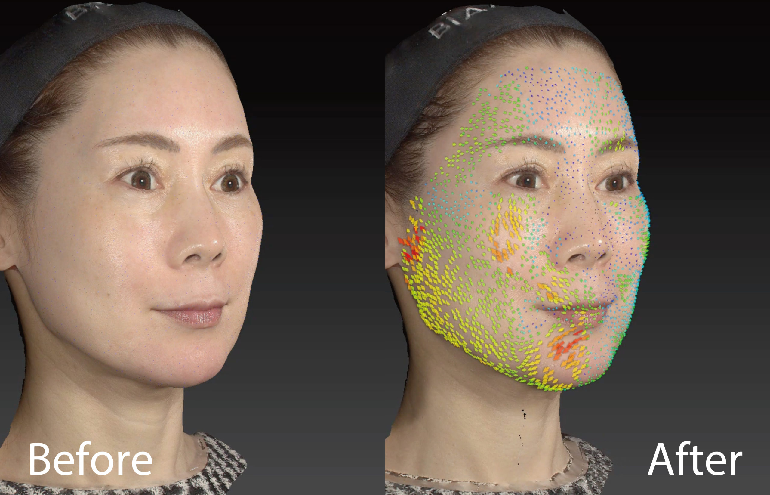 パーティーリフト（スマスアップネオ）