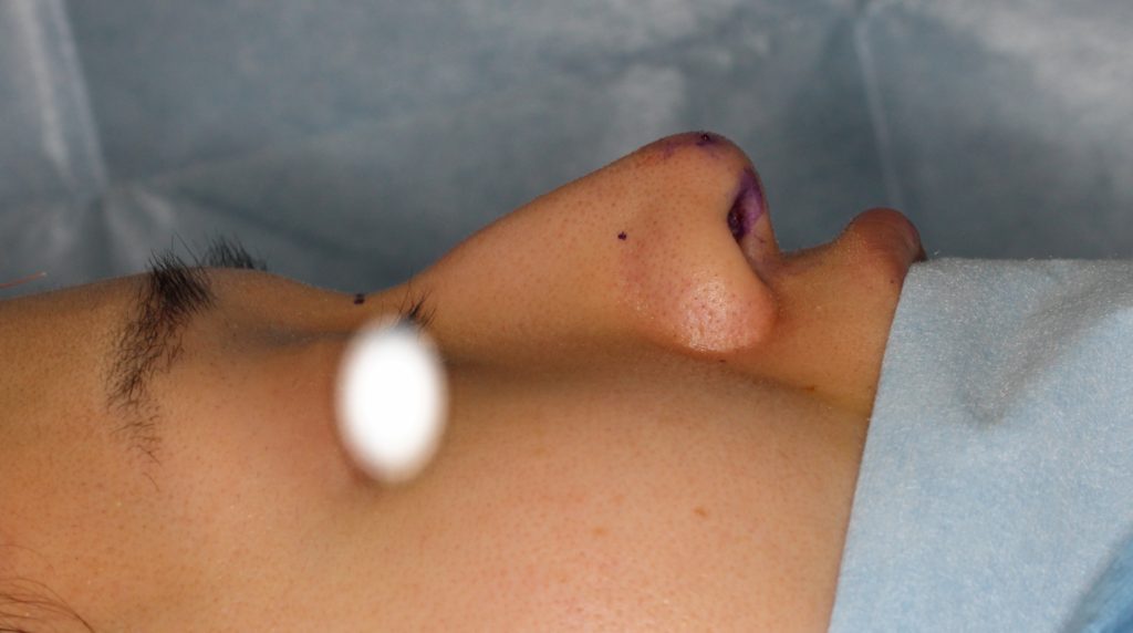 鷲鼻から鼻先ツンっ