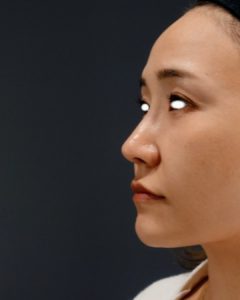 鼻整形