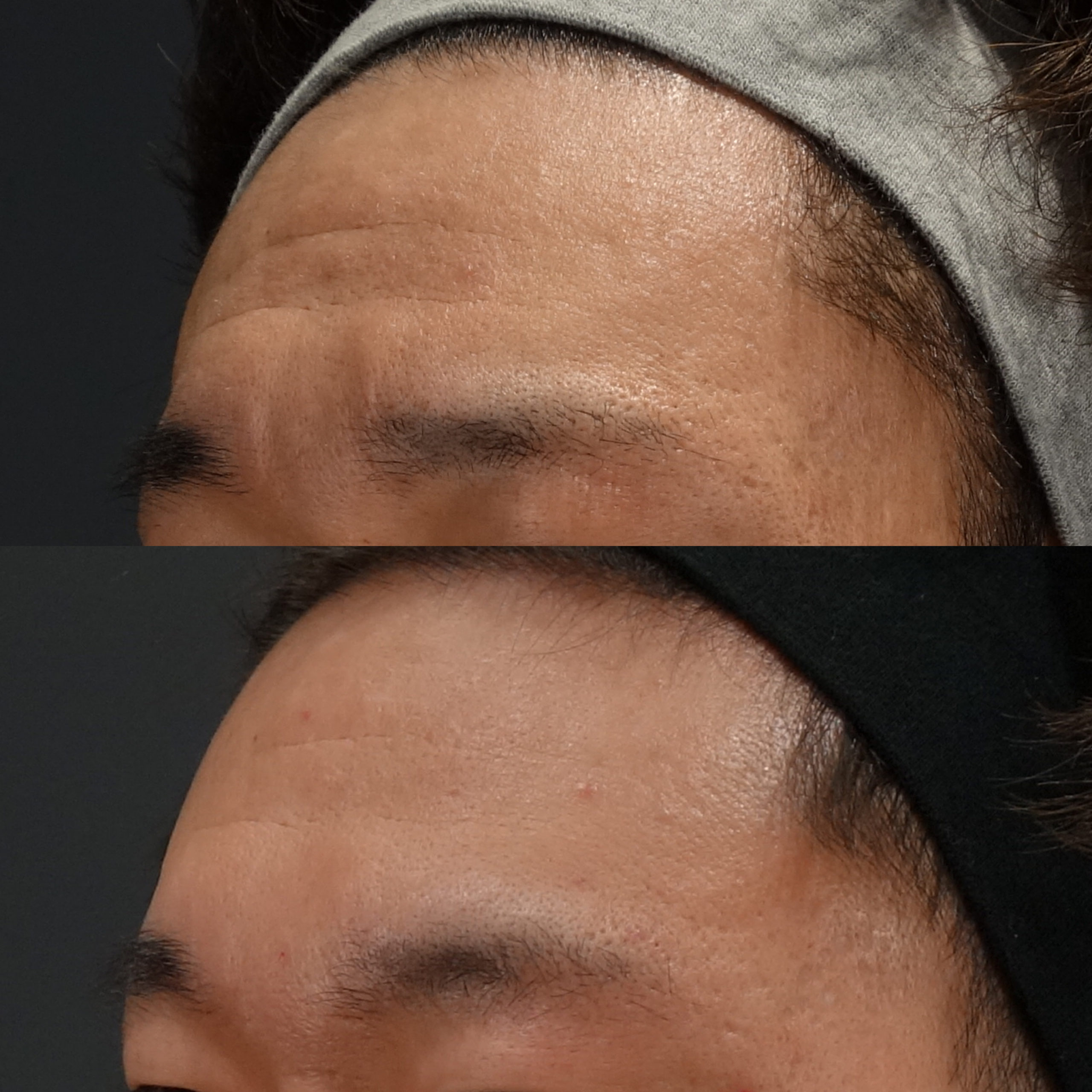 刻まれた深いシワに　ジュベルック