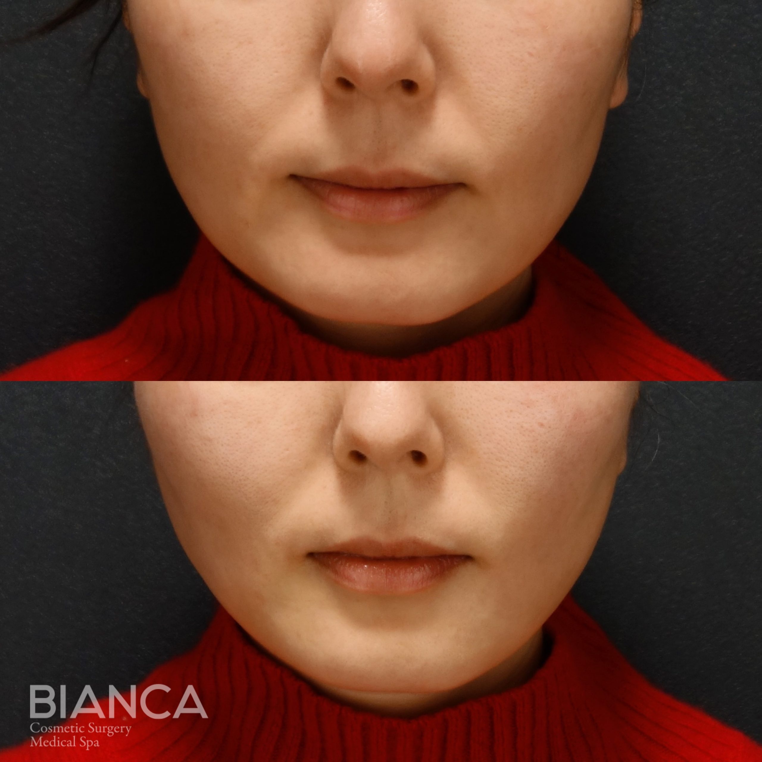 BIANCA LIFT✖TESS LIFT