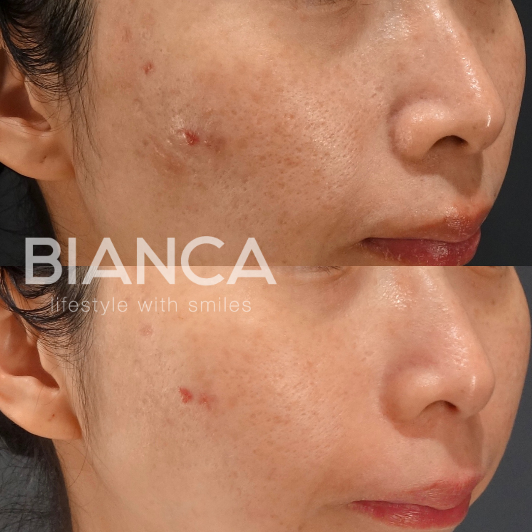 最新スキンブースター