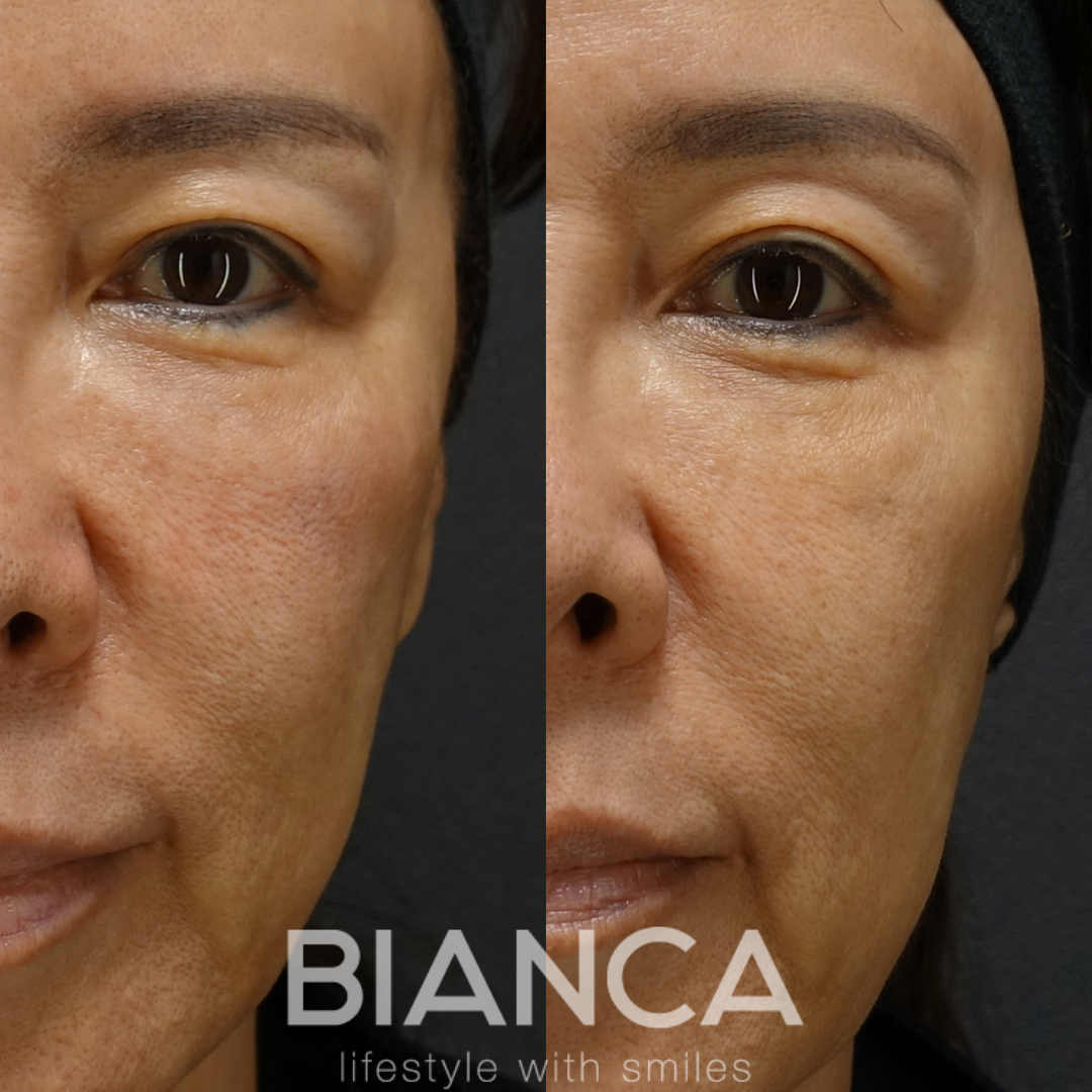 最新スキンブースター　ジュベルック