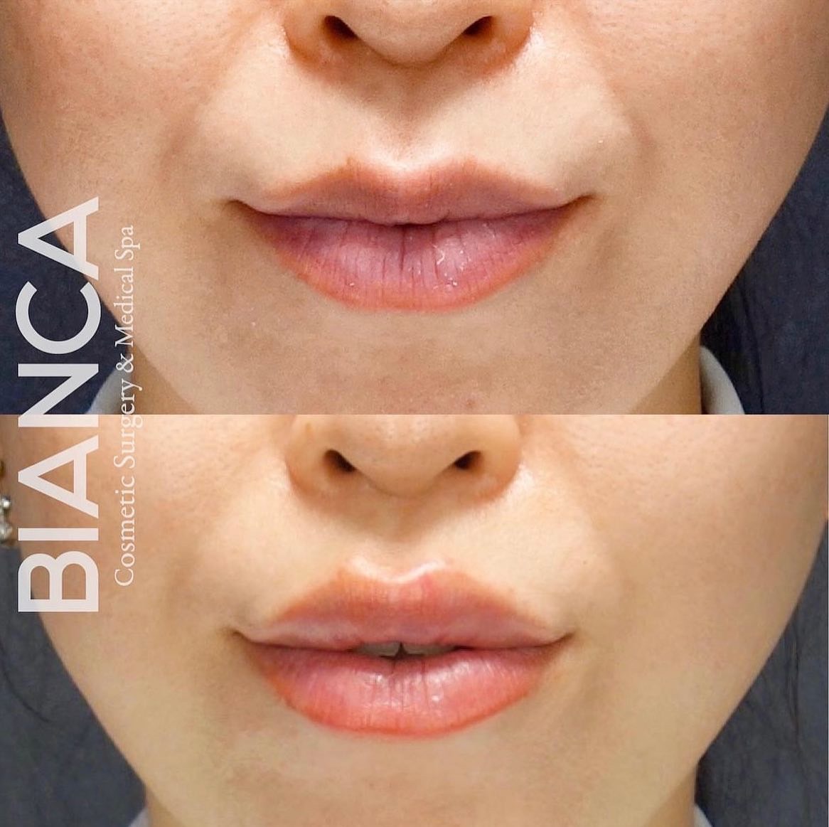 世界で流行りのRussian lip