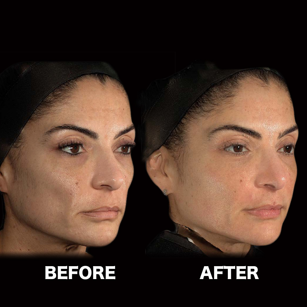 ハーモニカ（HArmonyCa）