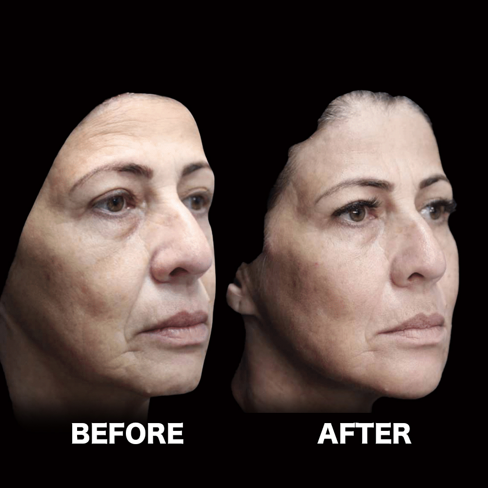 ハーモニカ（HArmonyCa）