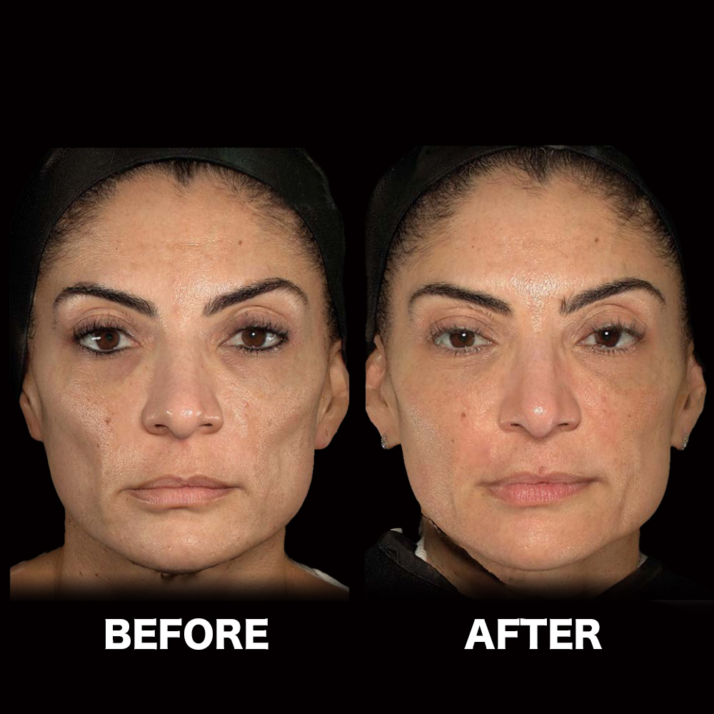 ハーモニカ（HArmonyCa）