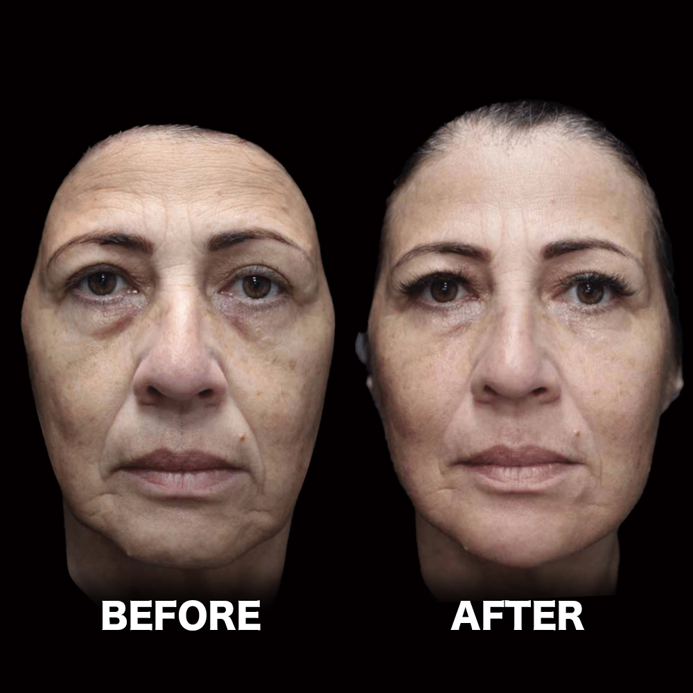 ハーモニカ（HArmonyCa）