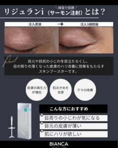 目元の小じわに対するリジュランiの症例