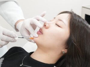 施術写真_注入_ヒアルロン酸注射