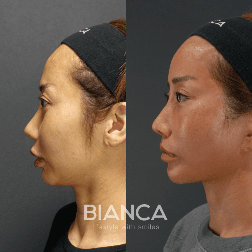 名称未設定のデザイン-2024-04-