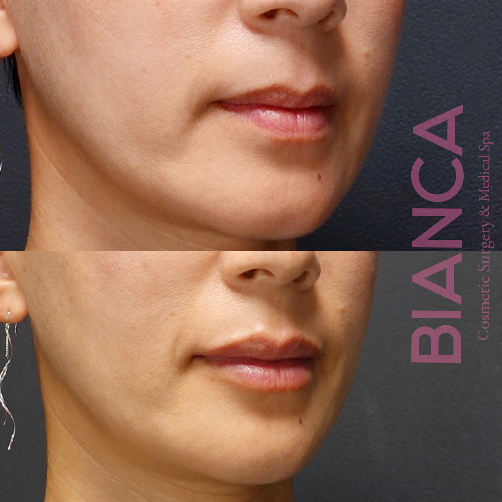 アンチエイジングで新しい自分に