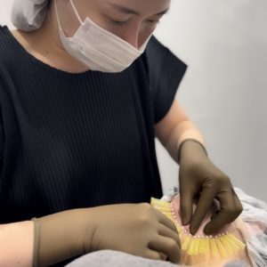 ショッピングリフト（ショッピングスレッド）の施術をする明石仙姫医師