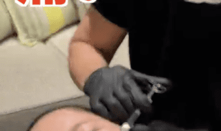 リジュランの施術の様子