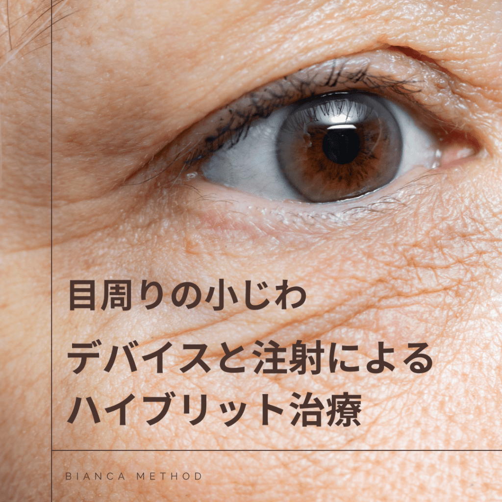 目元の小じわにリジュランi×ポテンツァSFAチップ！ホームケアや予防法をビアンカクリニック明石仙姫医師が解説