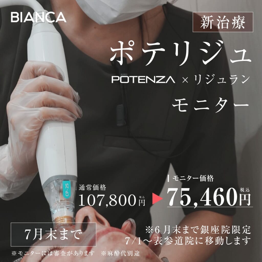 🍟ポテリジュ🍟