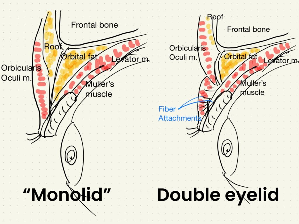 腫れぼったい目では二重になれない。の？
