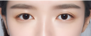 目の左右非対称の原因。二重ラインの左右差