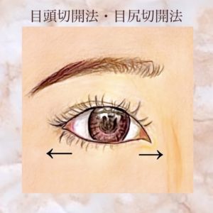 目の幅が狭いというお悩みの解決法として、目頭切開、目尻切開のイメージ。