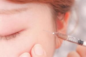 注射したところが痛いのはなぜ？ボトックス注射のイメージ