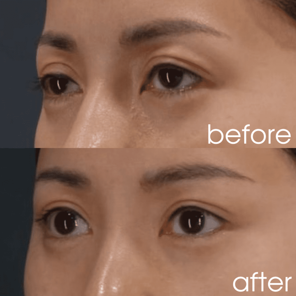 魅惑的な目元になる。きゅっと引き上がった目元を作るにはこめかみリフトがおすすめ。