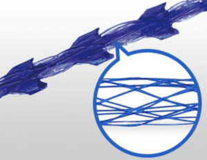 アルテミスリフトが注目を集める理由をビアンカドクターが解説！術後1ヶ月の経過は？