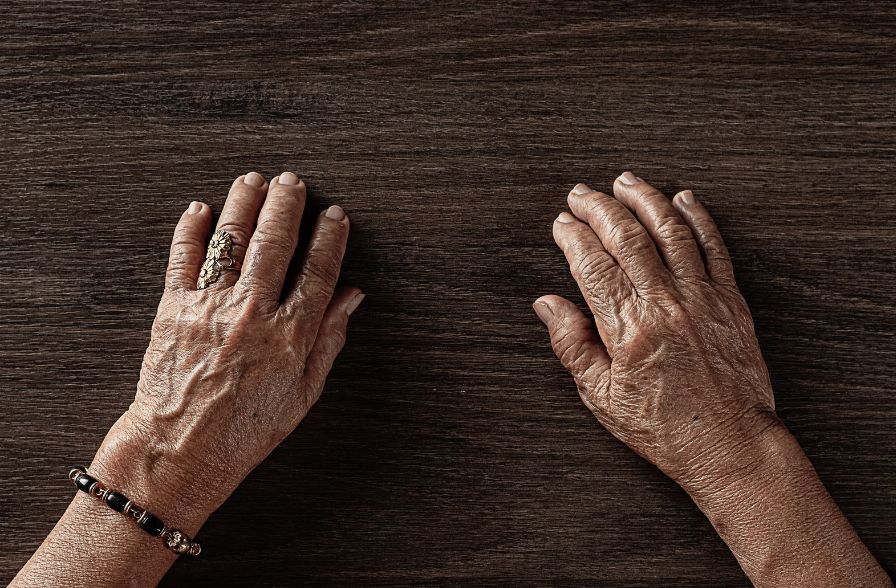 手の甲シリーズ第二弾！シワシワ、たるんだ手にはGOURIが効果的！！