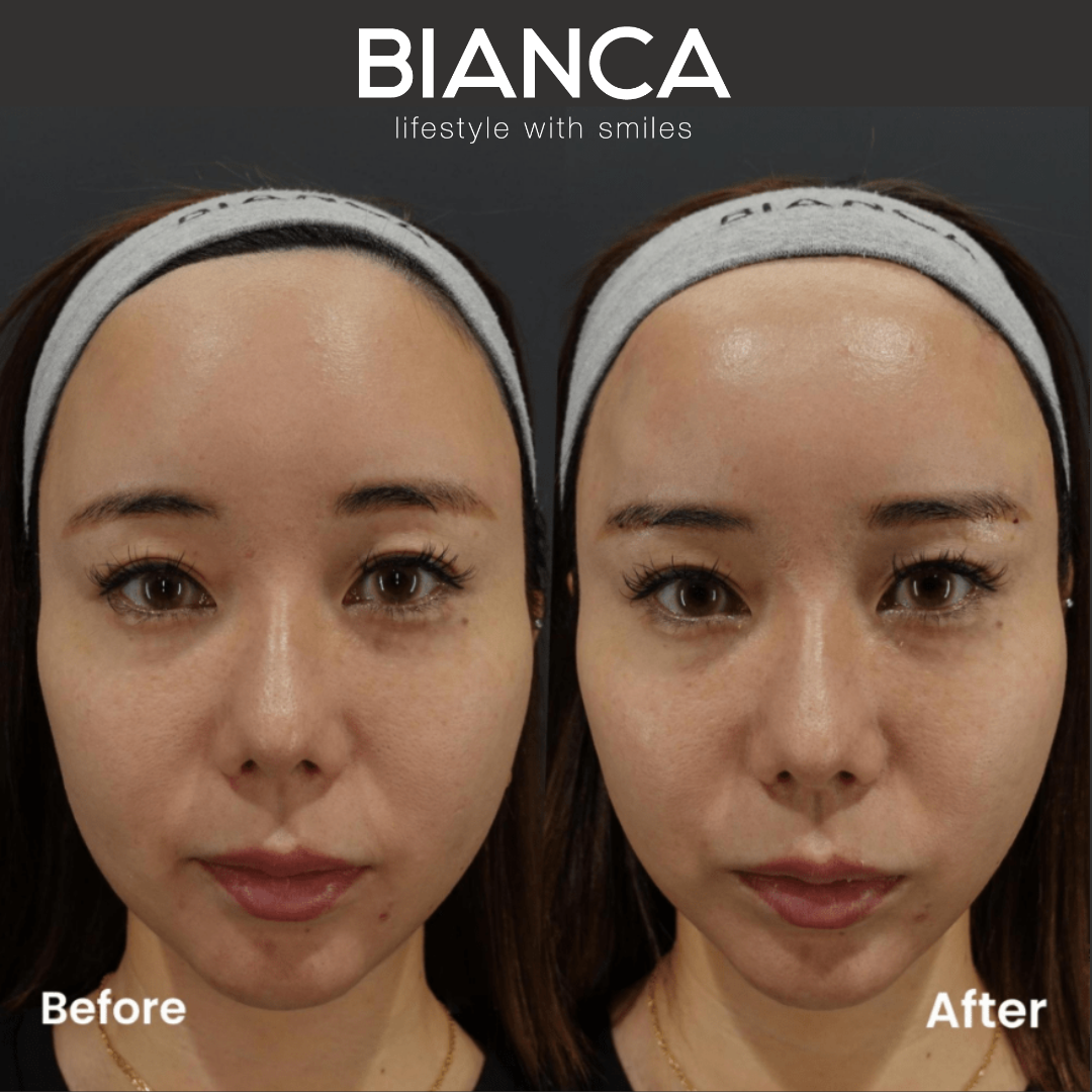 フォックスアイリフト ビアンカ銀座｜日本を代表する美容健康再生医療のクリニック