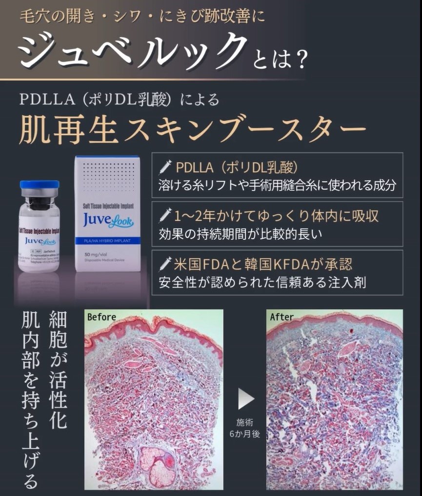 ジュベルックとは？主成分や効果