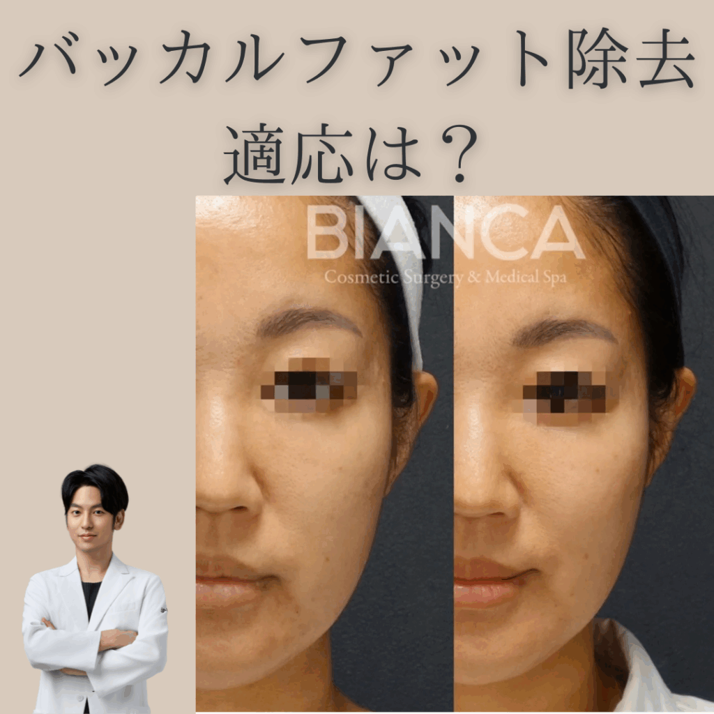 バッカルファット除去の適応は？