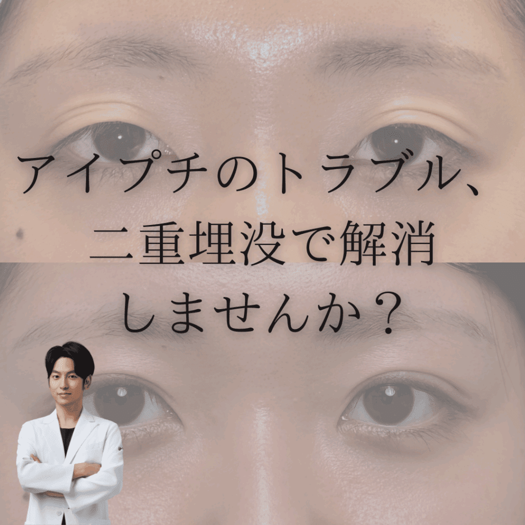 アイプチのトラブル、二重埋没で解消しませんか？