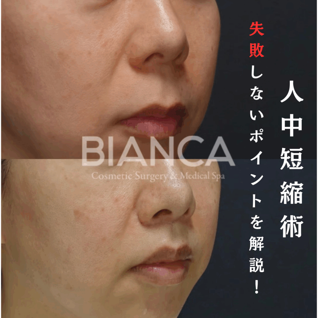 人中短縮で失敗しないポイントは？