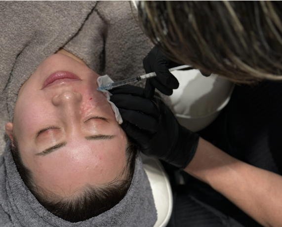 PN製剤とは？PDRNって何？