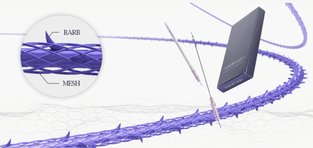 糸リフトの種類について解説！成功の秘訣とは！