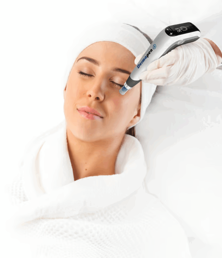 ダーマペンの効果はニキビ瘢痕治療に限らず！